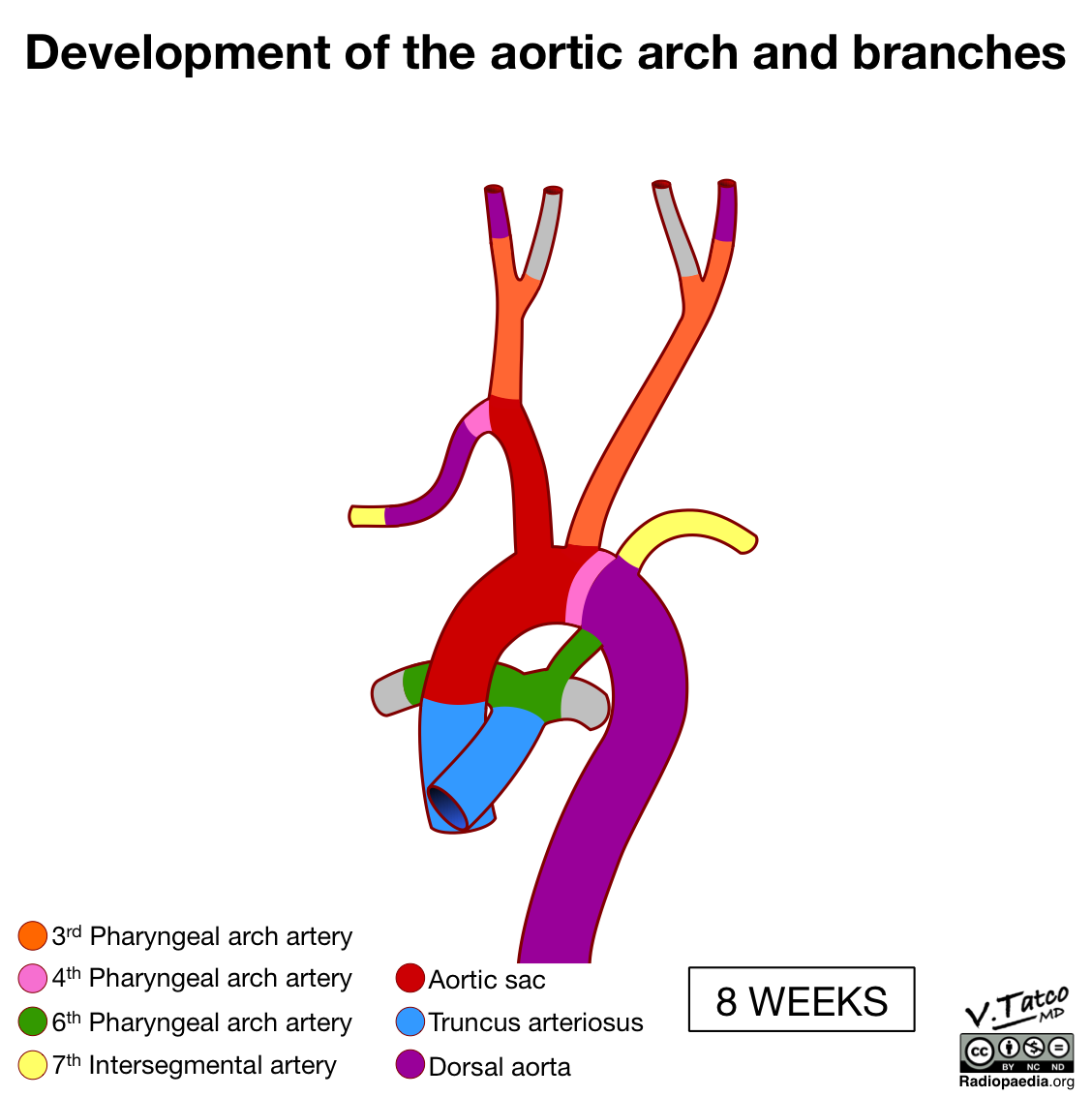 Radiopaedia Drawing Development Of The Aortic Arch And Branches At